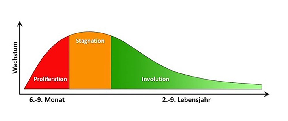 Wachstumsphasen eines Infantilen Hämangioms
