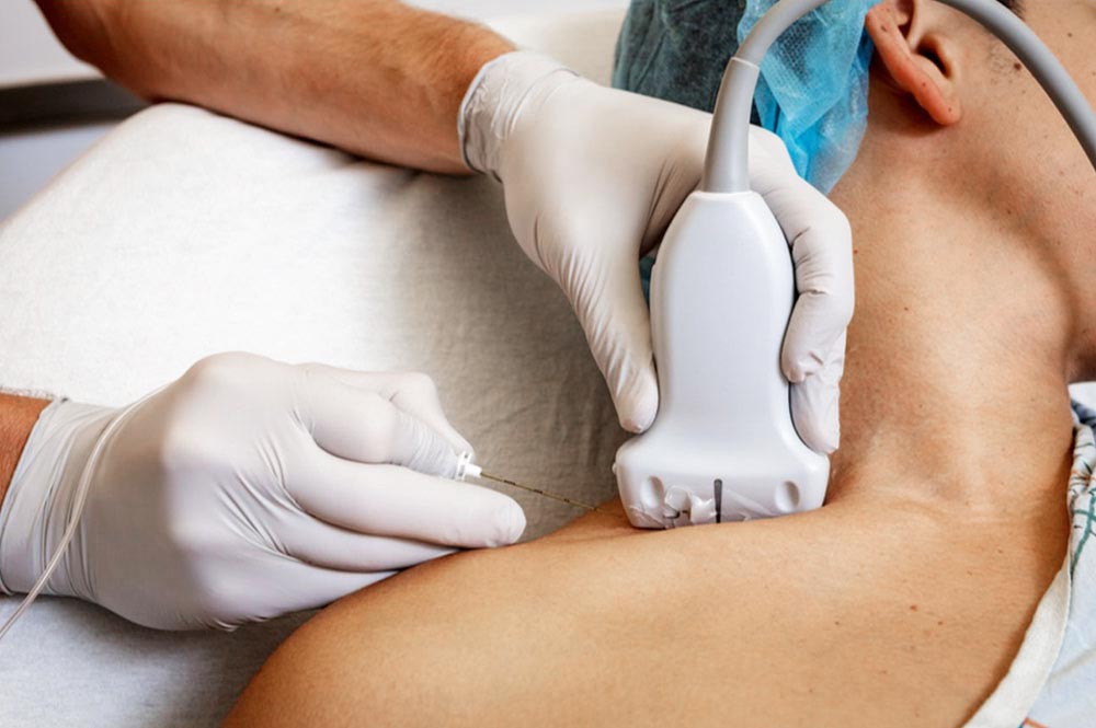 Narkose bei Patient