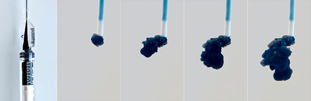 Flüssigembolisat Ethylen-Vinyl-Alkohol-Kopolymer