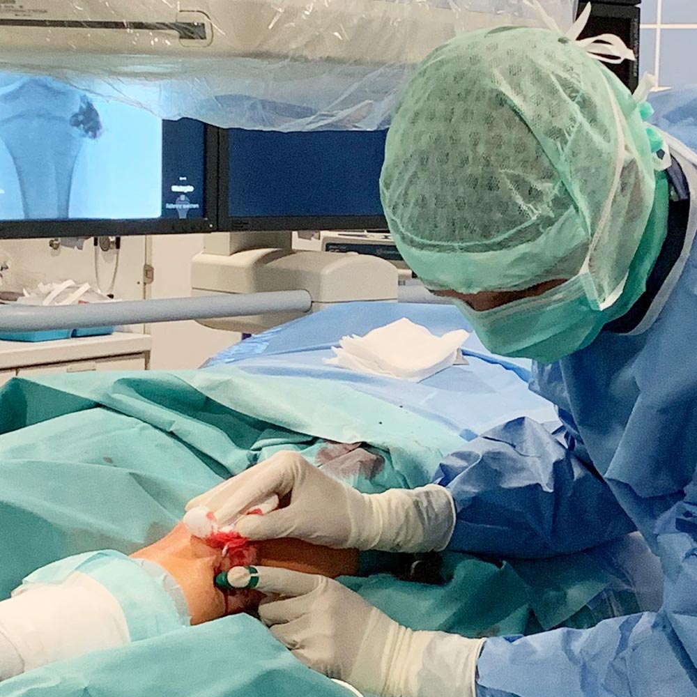 Elektrosklerotherapie bei venöser Malformation am Knie