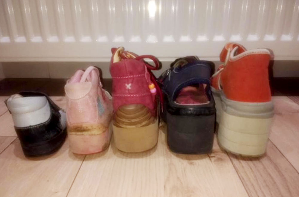 Schuhe einer jungen Patientin mit unterschiedlicher Beinlänge